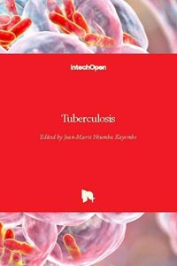 Tuberculosis