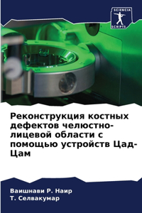 Реконструкция костных дефектов челюстно-