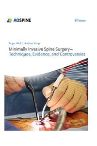 Minimally Invasive Spine Surgery - Techniques, Evidence, and Controversies