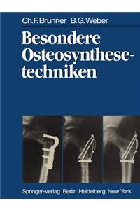 Besondere Osteosynthesetechniken