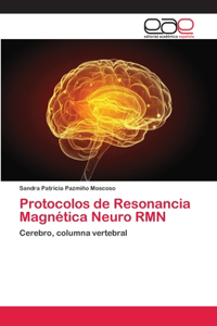 Protocolos de Resonancia Magnética Neuro RMN