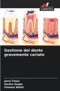 Gestione del dente gravemente cariato