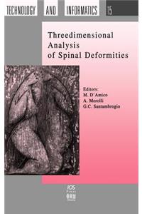 Three Dimensional Analysis of Spinal Deformities