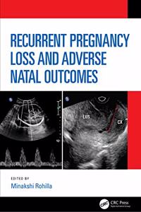 Recurrent Pregnancy Loss and Adverse Natal Outcomes