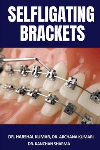 Selfligating Brackets