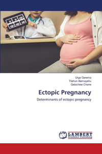 Ectopic Pregnancy