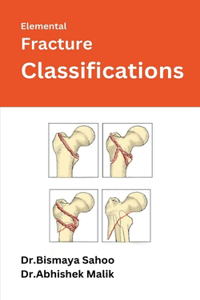 Elemental Fracture Classifications