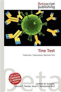Tine Test