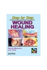 Step by Step Wound Healing with CD-ROM