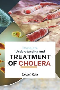 Complete Understanding and TREATMENT OF CHOLERA