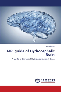 MRI guide of Hydrocephalic Brain