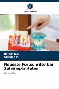 Neueste Fortschritte bei Zahnimplantaten