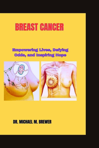 Breast Cancer