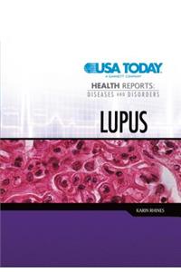 Lupus