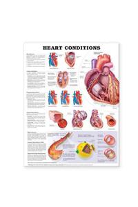 Heart Conditions