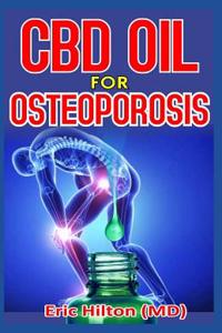 CBD Oil for Osteoporosis: Essential Remedy and Alternative Therapy for Osteoporosis