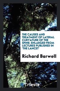 Causes and Treatment of Lateral Curvature of the Spine