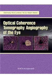 Optical Coherence Tomography Angiography of the Eye