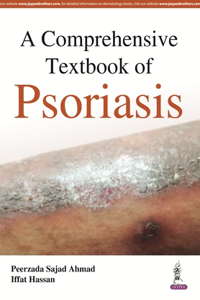 A Comprehensive Textbook of Psoriasis