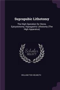 Suprapubic Lithotomy