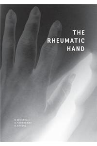 Rheumatic Hand