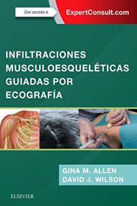 Infiltraciones musculoesqueleticas guiadas por ecografia