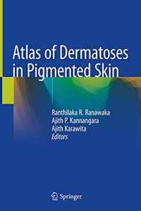 Atlas of Dermatoses in Pigmented Skin