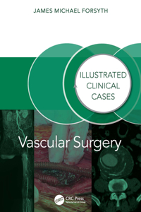 Vascular Surgery: