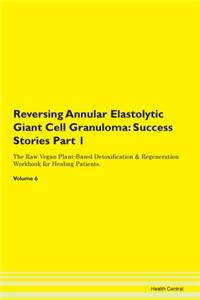 Reversing Annular Elastolytic Giant Cell