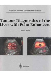 Tumor Diagnostics of the Liver with Echo Enhancers: Colour Atlas