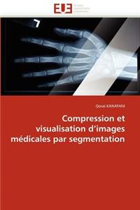 Compression Et Visualisation D Images Médicales Par Segmentation