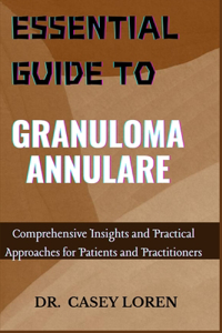Essential Guide to Granuloma Annulare