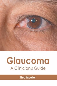Glaucoma: A Clinician's Guide