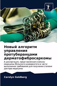 Новый алгоритм управления протуберанцам&