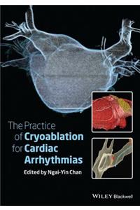 Practice of Catheter Cryoablation for Cardiac Arrhythmias
