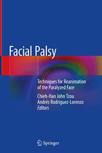 Facial Palsy