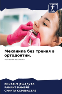 Механика без трения в ортодонтии.