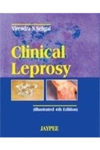 Clinical Leprosy