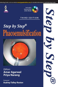 Step by Step Phacoemulsification