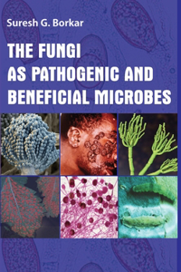 Fungi As Pathogenic And Beneficial Microbes