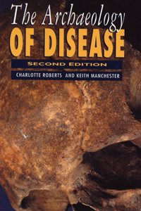 The Archaeology of Disease