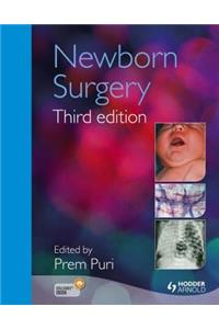 Newborn Surgery