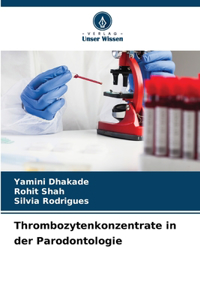 Thrombozytenkonzentrate in der Parodontologie