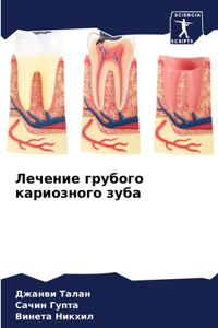 Лечение грубого кариозного зуба