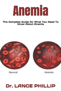 Anemia