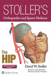 Stollers Orthopaedics and Sports Medicine: The Hip: Includes Stoller Lecture Videos and Stoller Notes