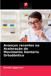 Avanços recentes na Aceleração do Movimento Dentário Ortodôntico