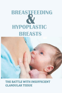 Breastfeeding & Hypoplastic Breasts