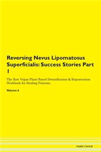 Reversing Nevus Lipomatosus Superficiali