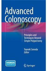 Advanced Colonoscopy